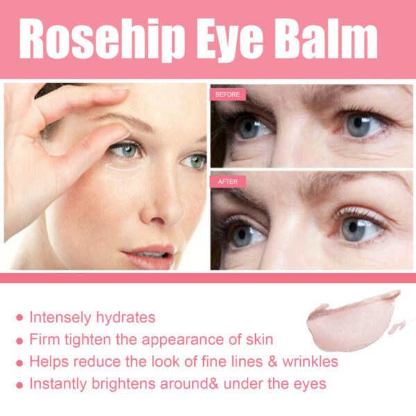 Women Extra Renewing Rosehip Eye Balm For Face Lifting Moisturizing Balm Stick Deep Hydration Moisturizer Eye Care - Image 3